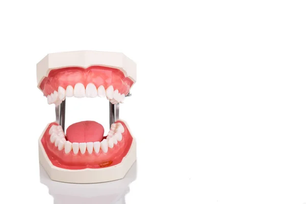 Dentista modelo de dentes ortodônticos com mandíbula aberta — Fotografia de Stock