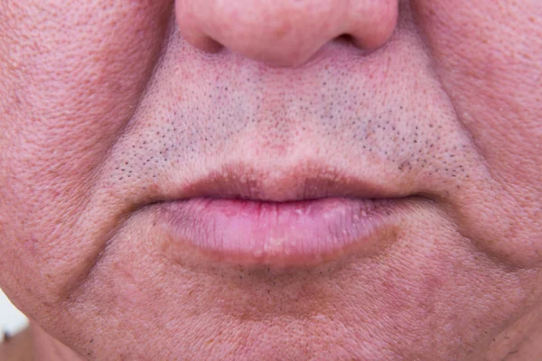 Närbild på saggy kinden hud mognat asiatiska människans — Stockfoto
