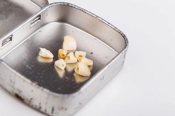 Collection of extracted milk teeth kept in box — Stock Photo, Image