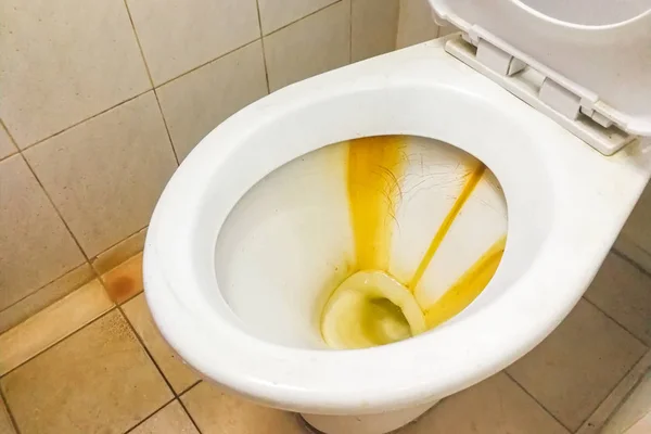 Schmutzige Toilettenschüssel mit Kalkfleckablagerungen — Stockfoto