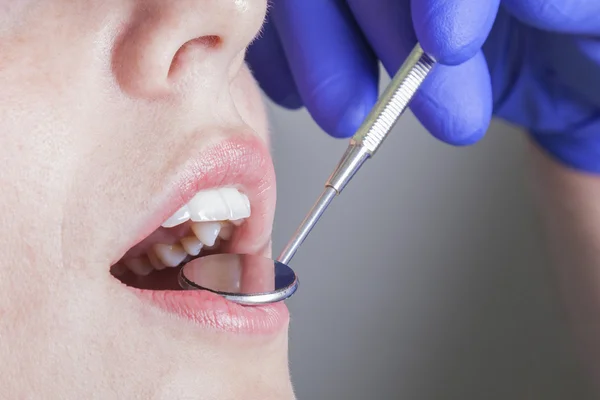 Zbliżenie kontroli zębów u dentysty — Zdjęcie stockowe