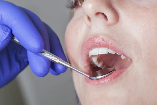 Detailní pohled z úst u zubaře — Stock fotografie