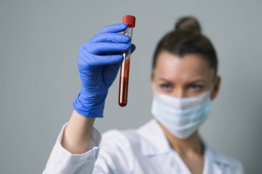 Kan testi. Kadın bir tıp çalışanı, üzerinde paciets kanı olan bir tüp tutuyor..