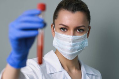 Kan testi. Kadın bir tıp çalışanı, üzerinde paciets kanı olan bir tüp tutuyor..