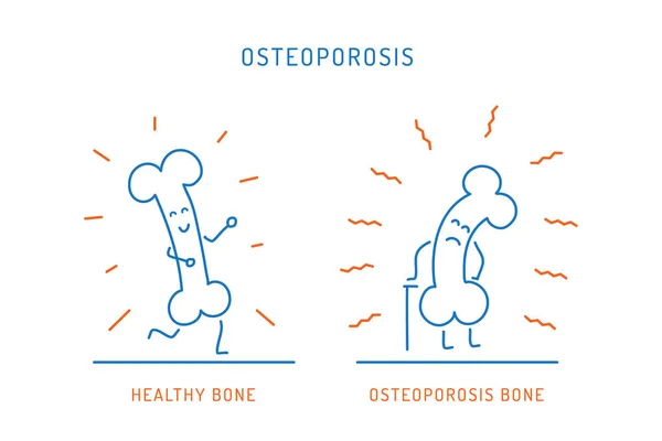 Карикатурная кость остеопороза — стоковый вектор