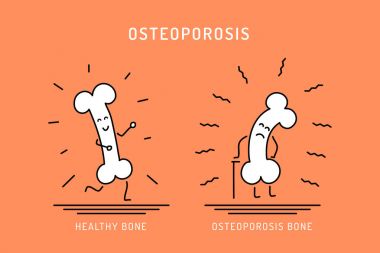 Osteoporosis cartoon bone clipart