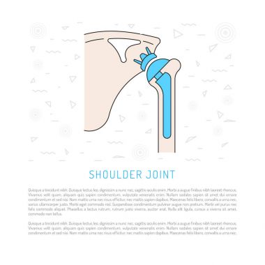 shoulder joint replacement clipart