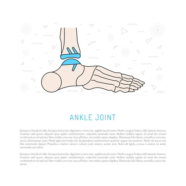 Ankle joint replacement — Stock Vector