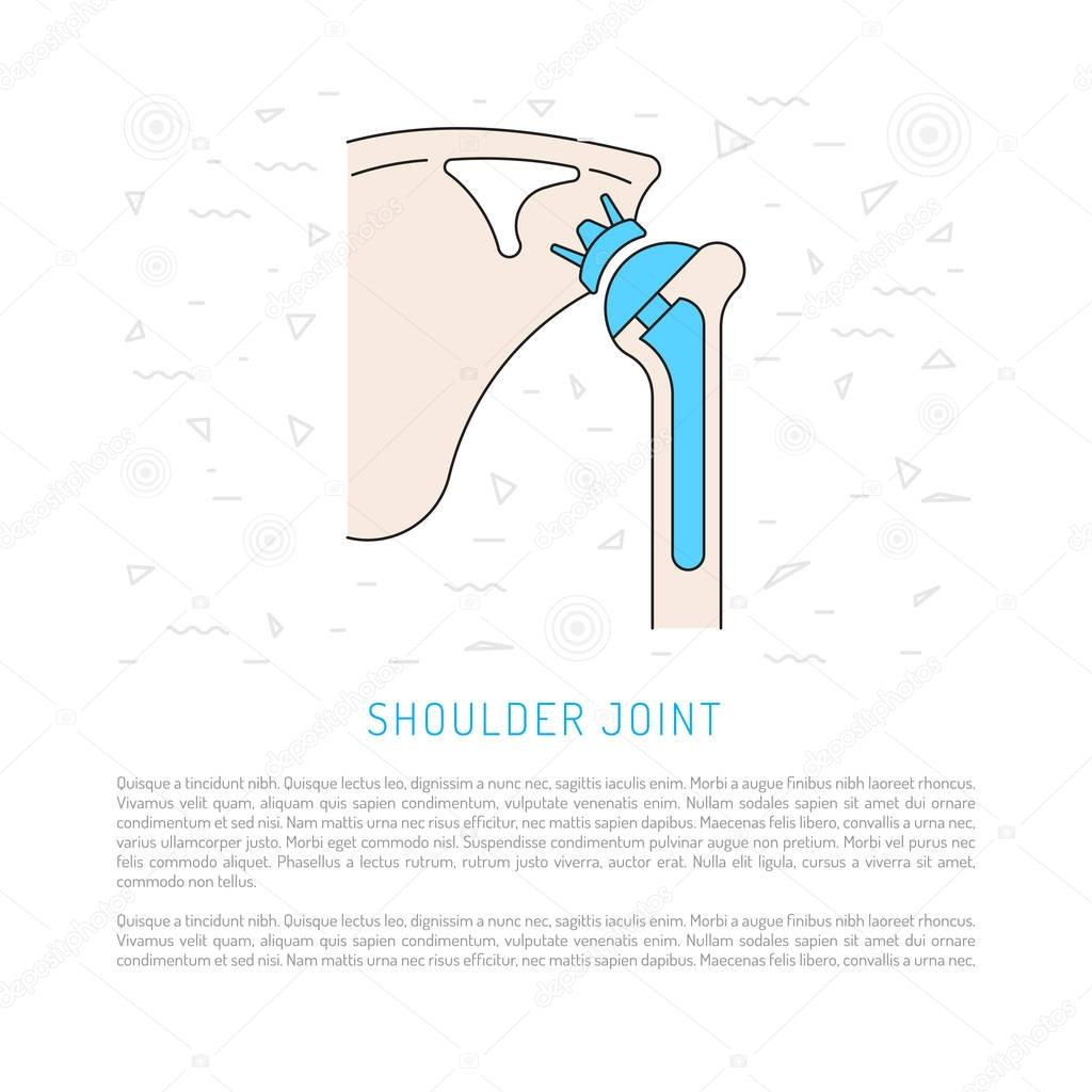 shoulder joint replacement