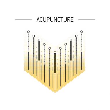 acupunkture geleneksel Çin tıbbı,