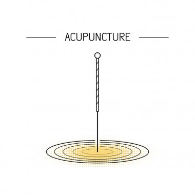 acupunkture geleneksel Çin tıbbı,