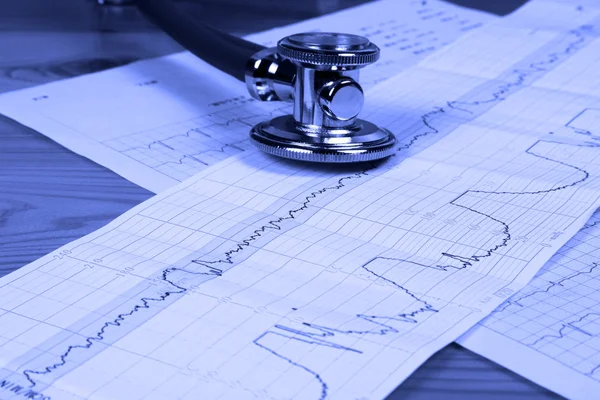 De stethoscoop en elektrocardiogram — Stockfoto