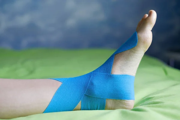 Elastische therapeutische blauwe tape toegepast op patiënten linkerbeen. — Stockfoto