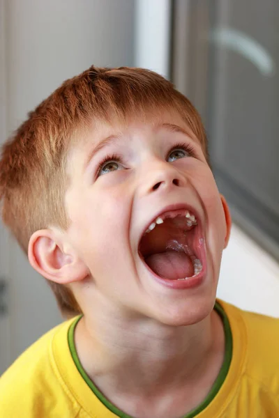 Retrato de un niño con una camiseta amarilla cuyos dientes de leche superiores delanteros se han caído —  Fotos de Stock