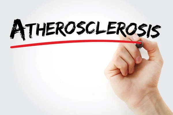 Hand writing Atherosclerosis with marker — Stock Photo, Image