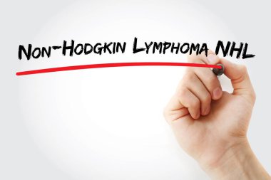 Non-Hodgkin Lenfoma Nhl yazma el
