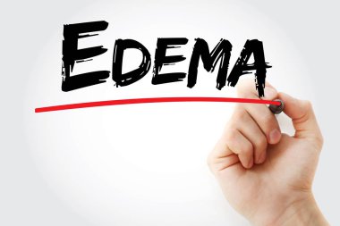 Edema text with marker clipart