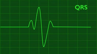 EKG Nabız Kaydı - HD video oluşturulmuş yeşil hat