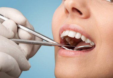 Kadın dişleri ve dişçi ağız aynası.