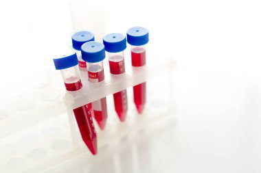 bilim laboratuvar test tüpleri 