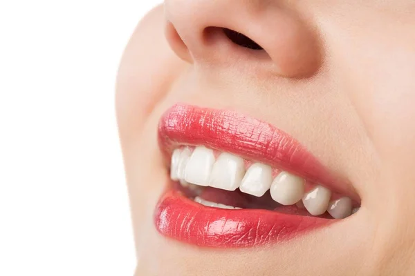 Mulher com dentes brancos saudáveis — Fotografia de Stock