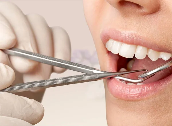 Vrouw tanden en een tandarts mond spiegel — Stockfoto