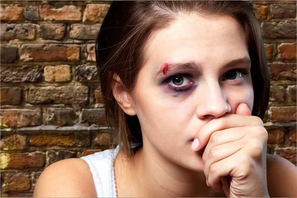 Aile içi şiddet mağduru kadın — Stok fotoğraf