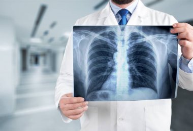 adam doktor holding x-ray