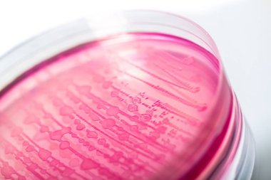  Bakteri kolonileri olan petri kabı 