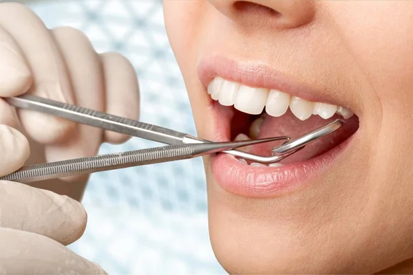 Dentes de mulher e um espelho de boca dentista — Fotografia de Stock