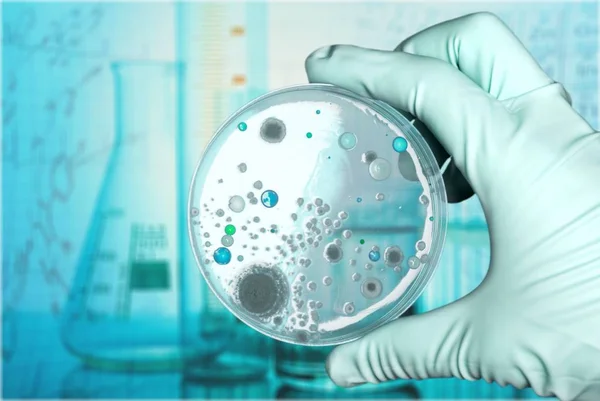 Микробиологический лабораторный тест в руке ученого — стоковое фото