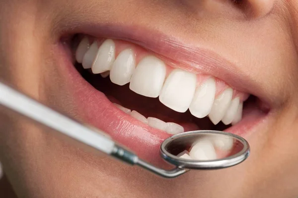 Woman teeth and a dentist mouth mirror — Stock Photo, Image