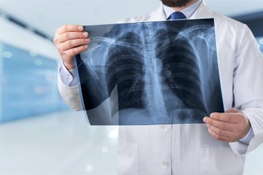 adam doktor holding x-ray