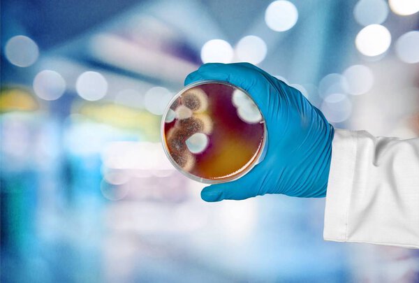 microbiology laboratory test in scientist hand