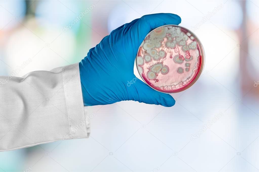 microbiology laboratory test in scientist hand