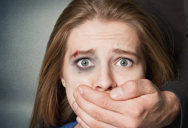Γυναίκα θύμα ενδοοικογενειακής βίας — Φωτογραφία Αρχείου