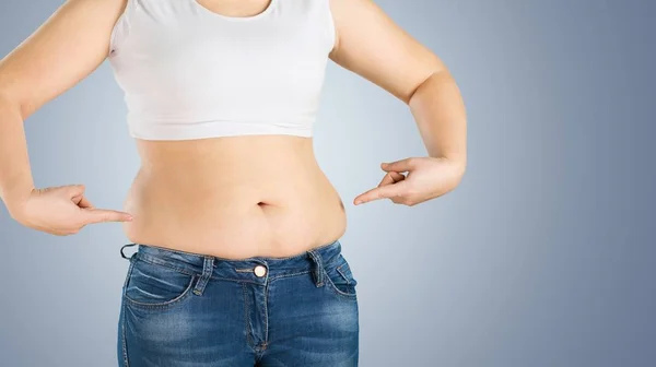 腹の脂肪の女性 — ストック写真