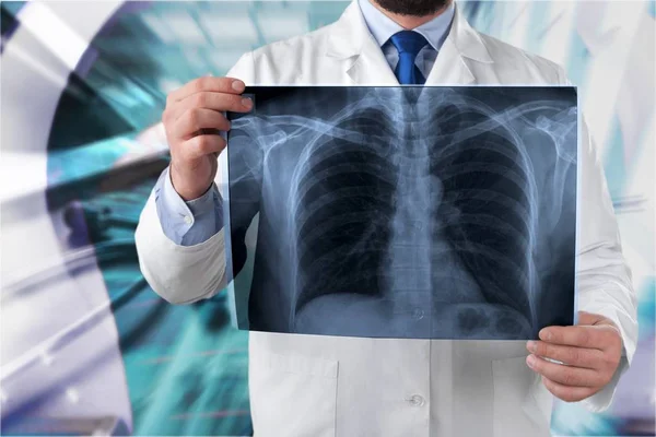Hombre médico celebración de rayos X — Foto de Stock