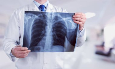 Doktor röntgeni inceliyor.