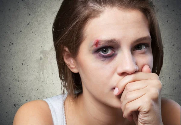 Mujer víctima de violencia doméstica — Foto de Stock