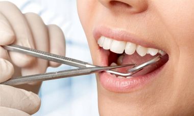 Kadın dişleri ve dişçi ağız aynası.