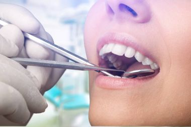 Kadın dişleri ve dişçi ağız aynası.