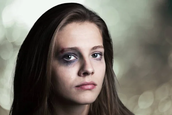 가정폭력의 피해자인 여자 — 스톡 사진