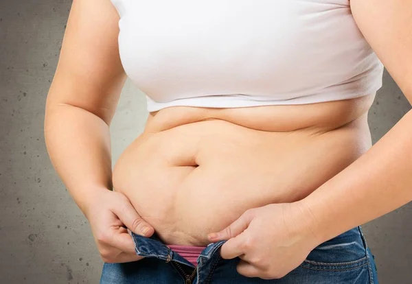 Женщина с жирным животом — стоковое фото