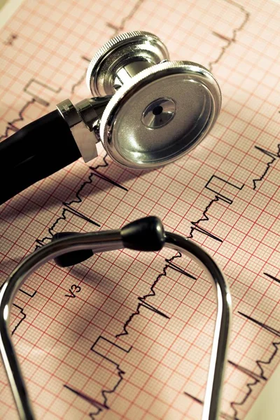 Rapport stéthoscope sur électrocardiogramme — Photo