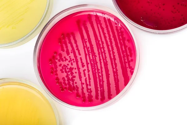 Placa de Petri con colonias bacterianas — Foto de Stock