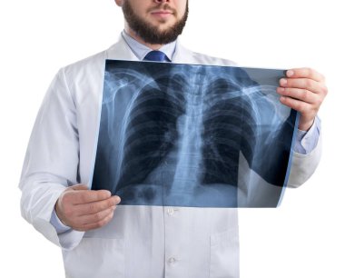 Doktor röntgeni inceliyor.