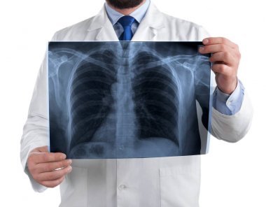 Beyaz arka plan üzerinde izole x-ışını inceleyerek doktor 