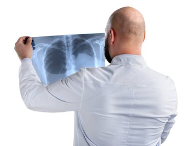 Doktor röntgeni inceliyor.