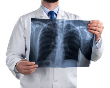 Doktor röntgeni inceliyor.